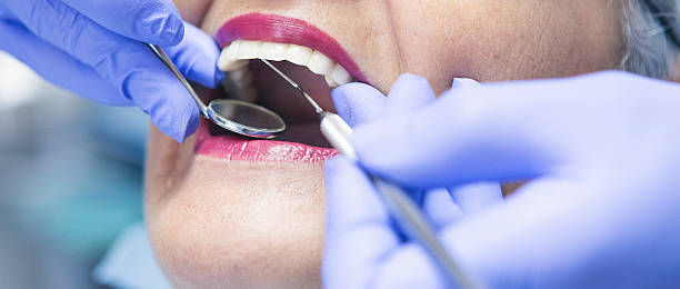 Best Emergency Broken Tooth Repair in Los Chaves, NM