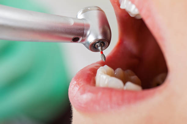 Best Emergency Treatment for Toothache in Los Chaves, NM